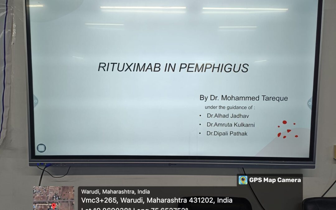 Rituximab in Pemphigus